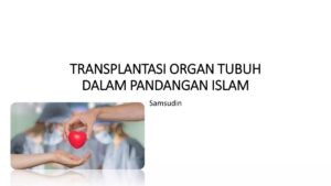 Dampak Positif dan Negatif Transplantasi Organ
