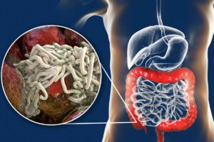 Larva cacing yang hidup pada tubuh sapi