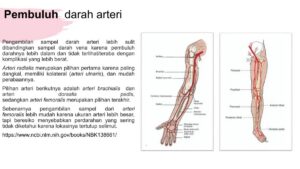 Ukuran Aorta Lebih Besar Dibanding Pembuluh Darah Lain