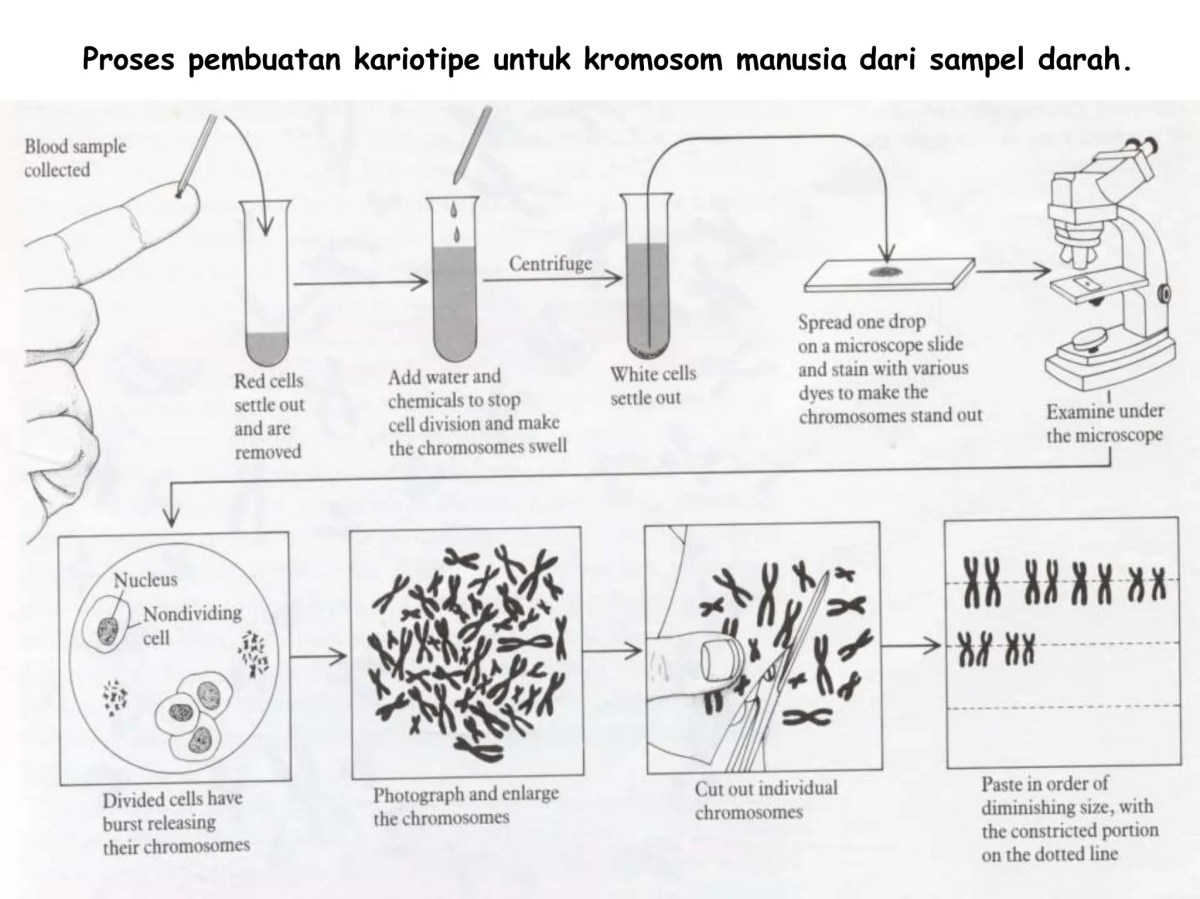 Segmen asam nukleat pada lokus yang menentukan fenotip