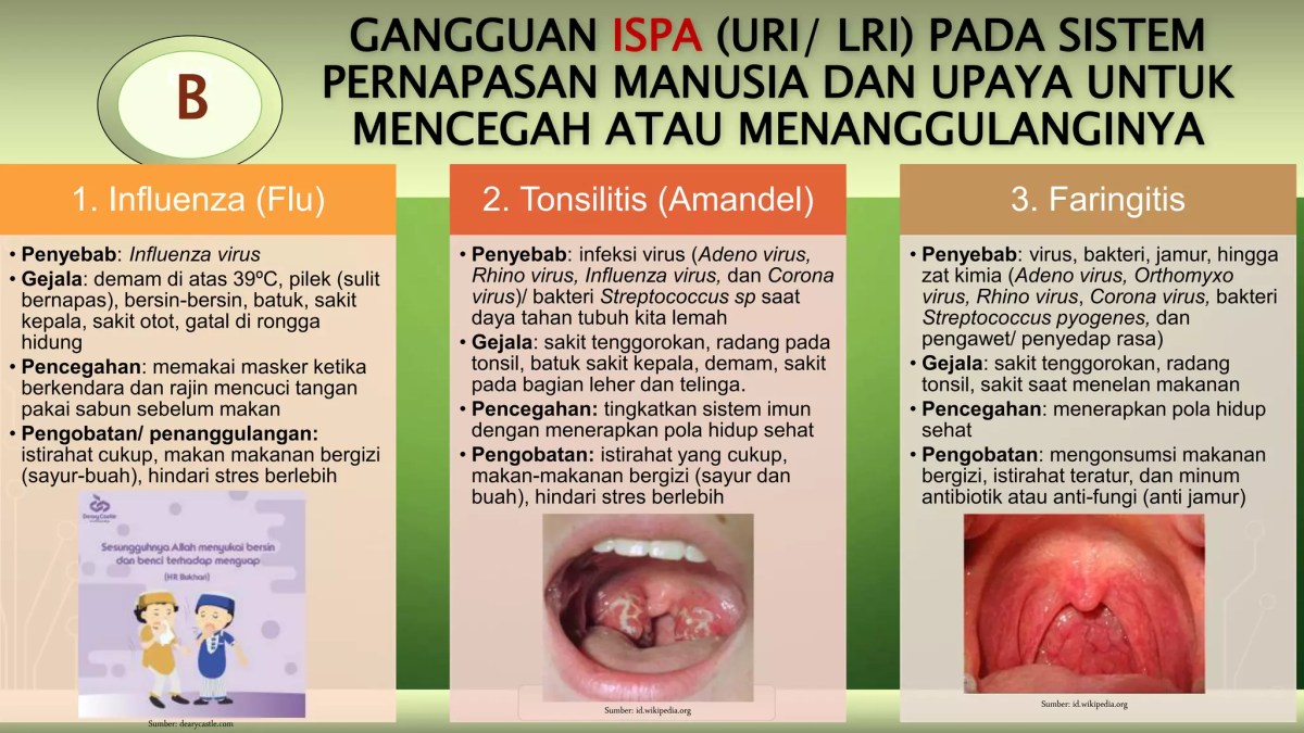 Amandel dan Polip: Penyebab Gangguan Pernapasan