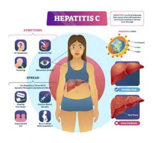 Pengertian Hepatitis