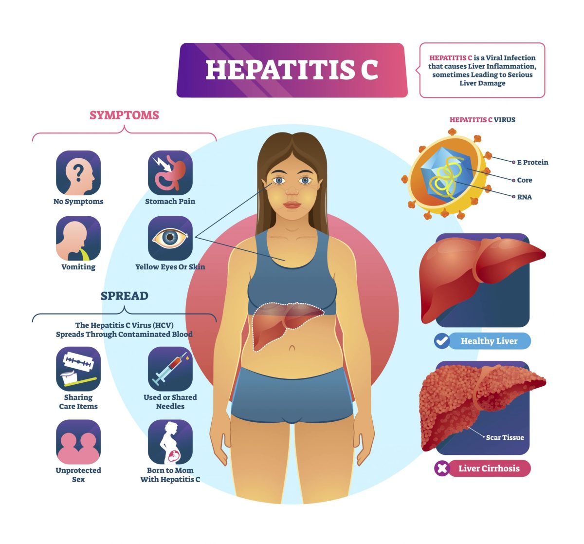 Pengertian Hepatitis