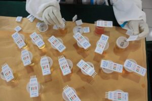 Tes urin dapat mengungkap konsumsi narkoba