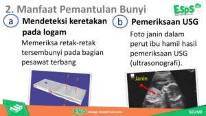 Pemanfaatan Gelombang Bunyi: Deteksi Keretakan Logam, Umur Batuan, USG Janin, Kedalaman Laut