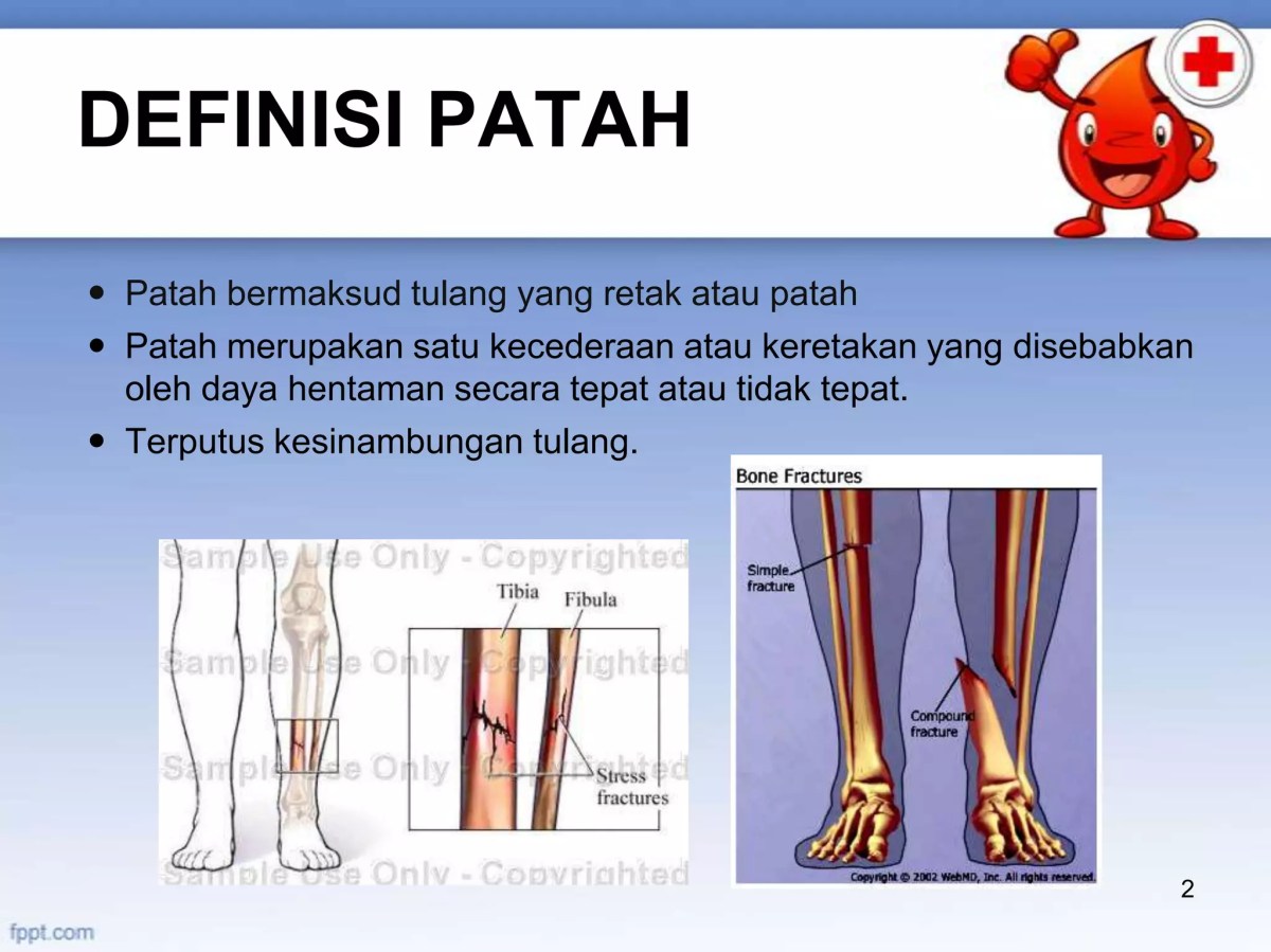 Keretakan Tulang Lengan: Kelainan yang Dikenal