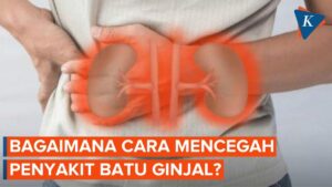 Sakit Akibat Batu Ginjal di Bagian Tertentu