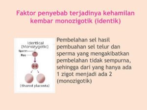 Asal Kembar Identik dari Ovum