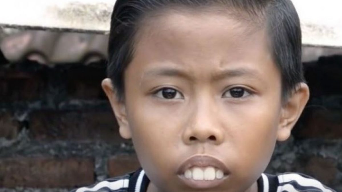 Gigi boneng dalam bahasa Inggris