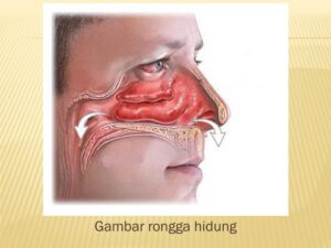 Katup Penutup Rongga Hidung pada Faring